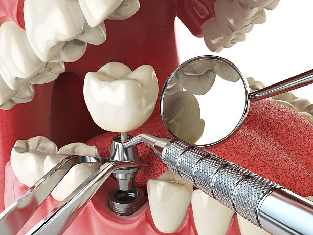 Best Emergency Orthodontic Repairs in Silver Grove, KY